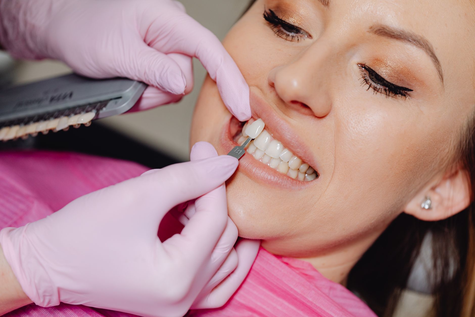 timing of A smile makeover