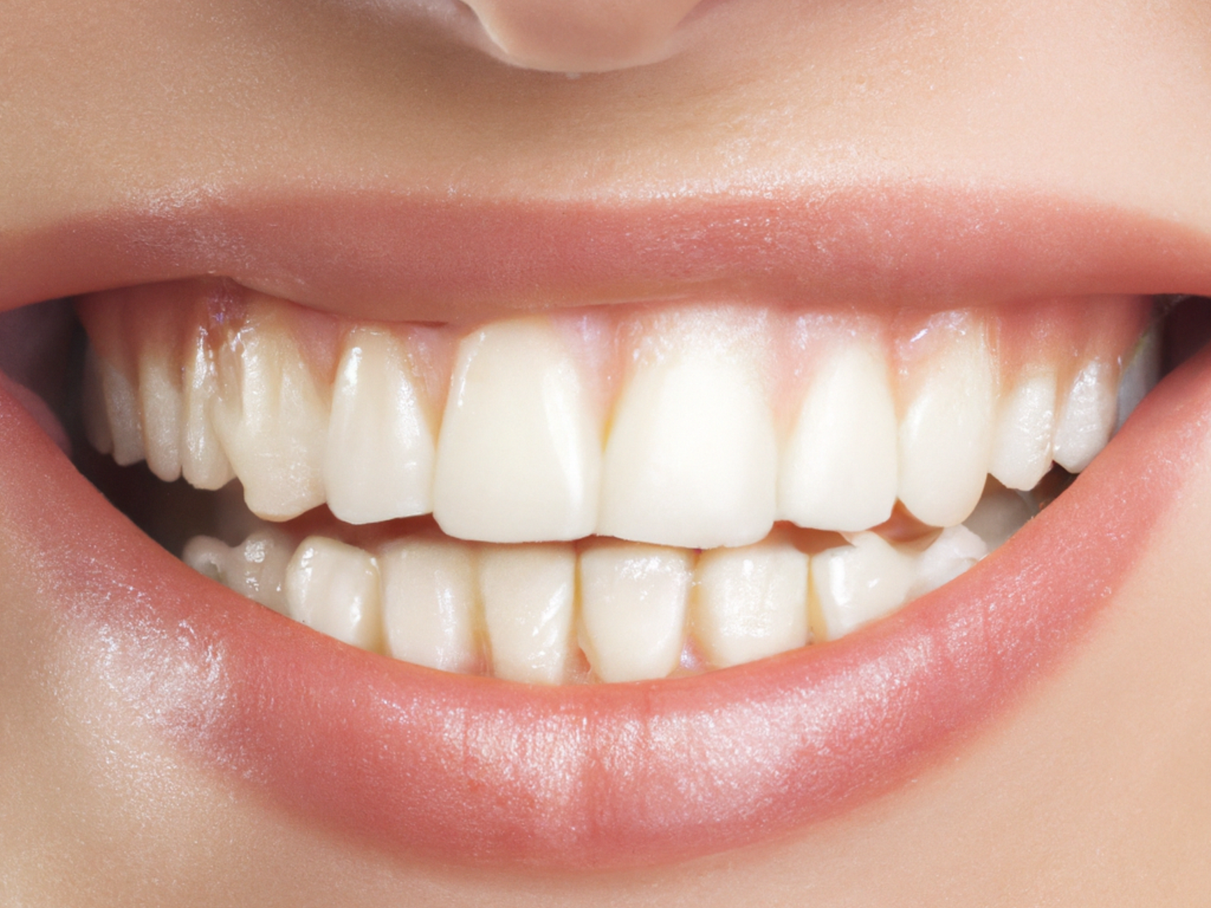 uneven gum height
